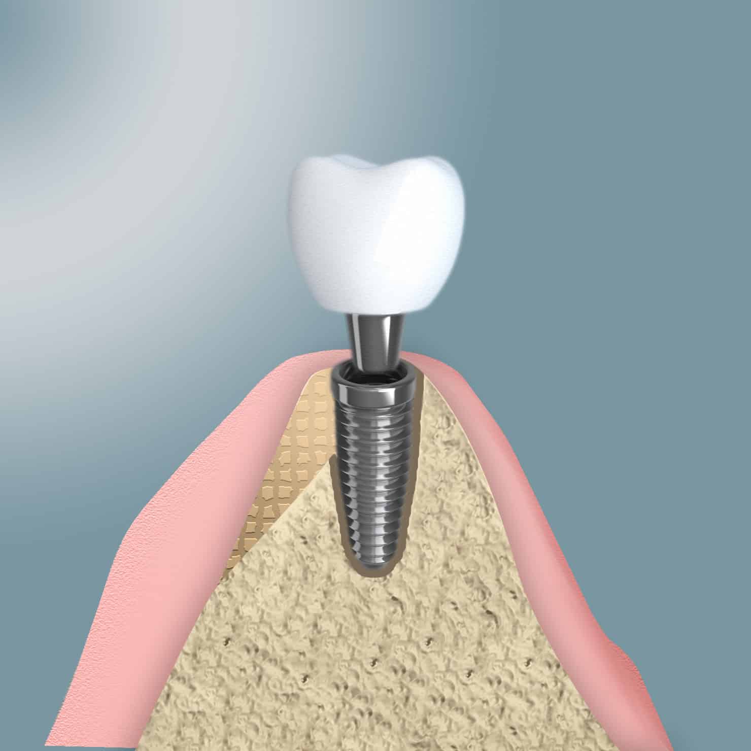 procedure